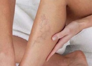 Tips om je bloedsomloop te verbeteren