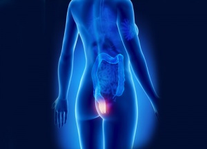 Aaambeien tijdig ontdekken en voorkomen