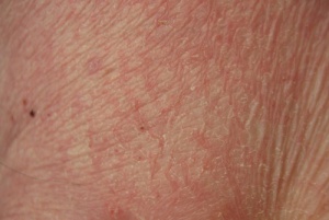 Je huid en je gezondheid