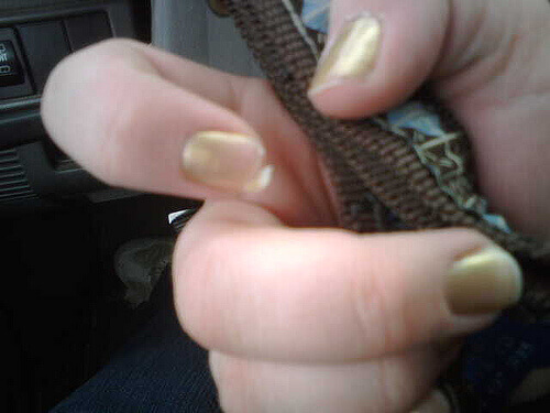 Meisje met goud gelakte schilferende nagels