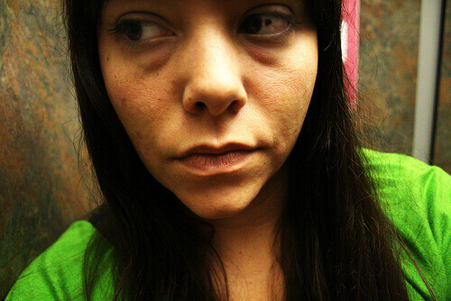 vroegtijdige rimpels