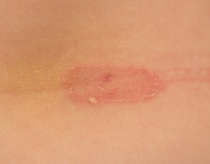 Hoe voorkom je schimmels?