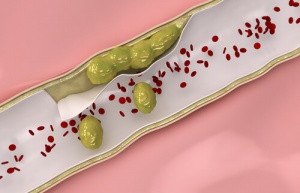 Natuurlijke remedies om je aderen te reinigen