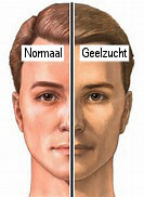 gal7
