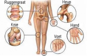 Zeg vaarwel tegen gewrichtspijn: 5 geteste remedies