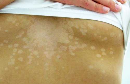 5 manieren waarop je huid aangeeft dat er iets niet goed is