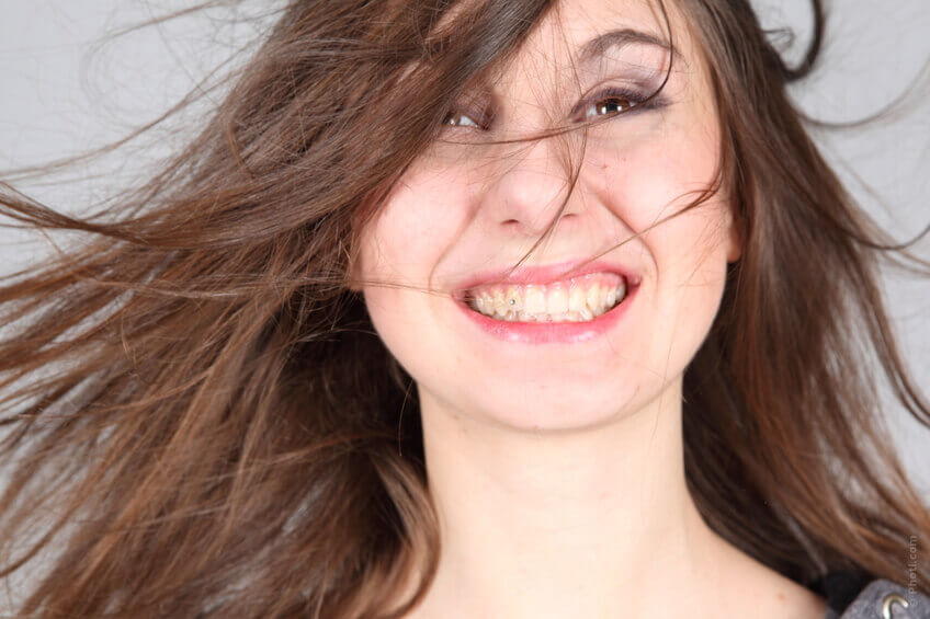 Lach zo vaak je kunt