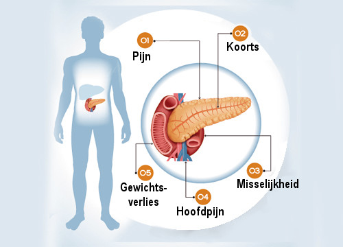 6 symptomen van een aandoening aan de pancreas