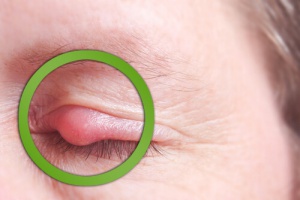 Hoe kun je snel een 'strontje' genezen?