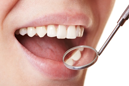5 middelen die tandplak echt verwijderen