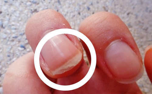 Tips om broze nagels sterker te maken