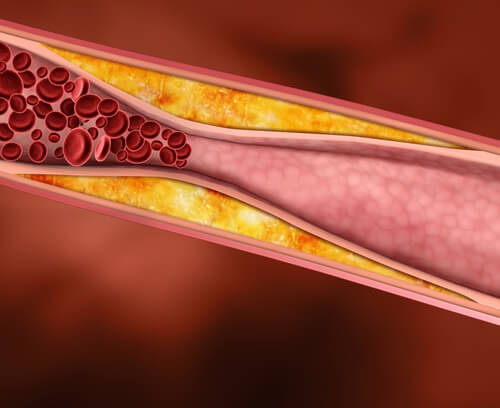 Cholesterol verminderen met geneeskrachtige planten Cholesterol verminderen met geneeskrachtige planten