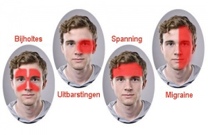 Nieuwe en effectieve behandeling tegen migraine