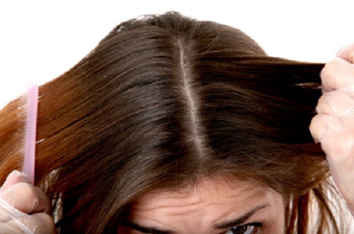 vet haar