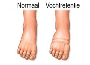 Wat kun je doen om vochtophoping te voorkomen?