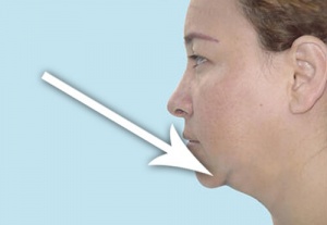 4 tips om de huid rond je hals af te slanken