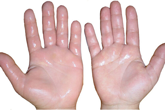 Wist je deze 9 dingen over het menselijk lichaam zoals het feit dat linkshandigen sterker zijn dan rechtshandigen