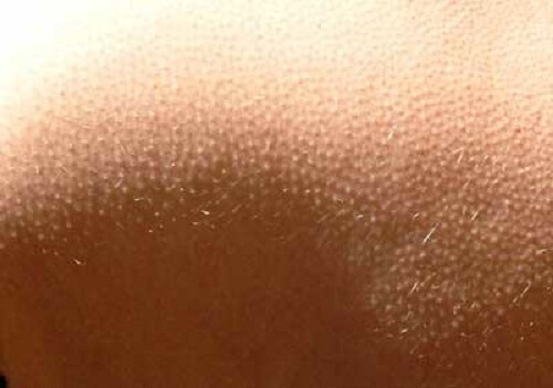 Wist je deze 9 dingen over het menselijk lichaam