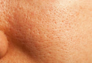 Remedies om je poriën natuurlijk te sluiten