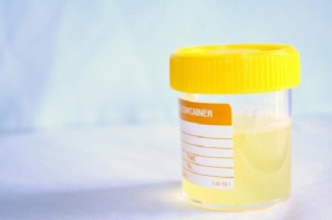 Huismiddeltjes en tips tegen urineweginfecties