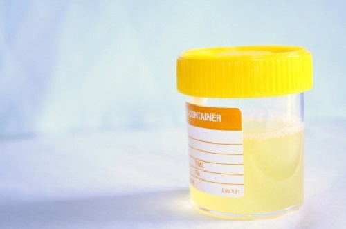 Huismiddeltjes en tips tegen urineweginfecties