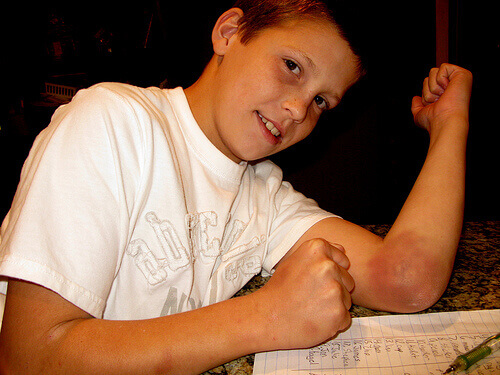 Blauwe Plek op de Elleboog