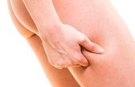 Hoe vecht je tegen cellulite? Hoe vecht je tegen cellulite?