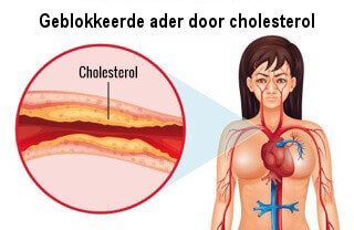 cholesterol-ader-tekening