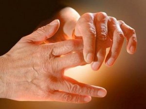 Oorzaken van een tintelend gevoel in de handen en benen