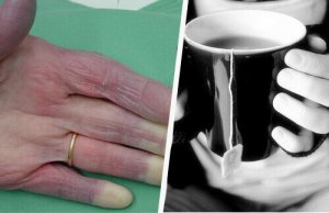 Een aantal mogelijke oorzaken van koude handen