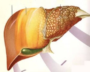 Fruit dat helpt tegen leververvetting