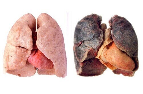 Tips voor schonere longen