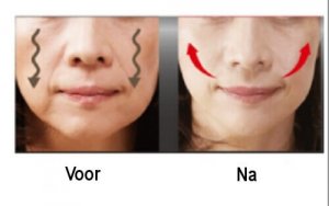 4 tips om hamsterwangen te verminderen