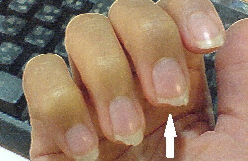 Afbrekende nagels voorkomen met deze tips