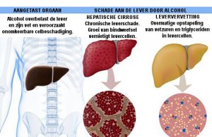 Gevolgen van alcohol