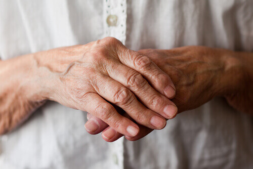 handen met artritis