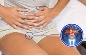 7 waarschuwingstekens van baarmoederhalskanker