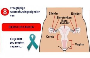 8 vroege tekenen van eierstokkanker