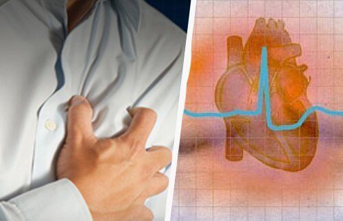 Hartritmestoornissen: symptomen en gevolgen