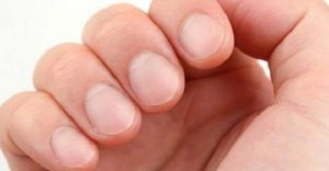 Wat zeggen je nagels over je gezondheid?