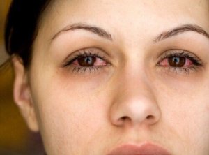 Zo weet je of je meer slaap moet hebben