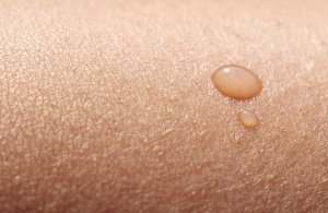Droge huid natuurlijk behandelen