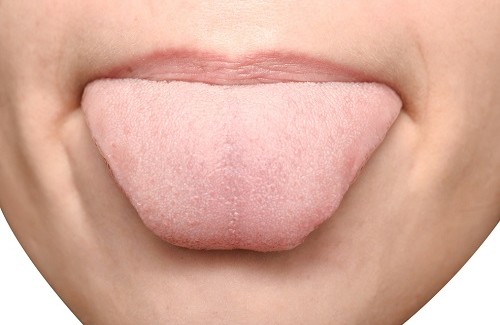 Wat vertelt je tong over je gezondheid?