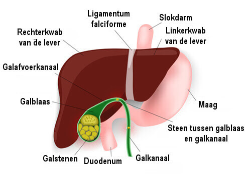 galblaas-problemen