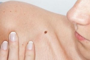 7 gevaarlijke symptomen die elke vrouw moet herkennen