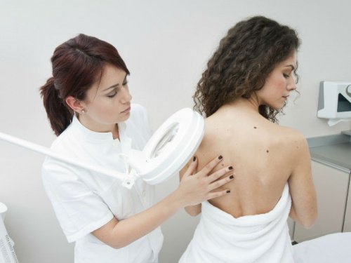 Moedervlekken Onderzoeken