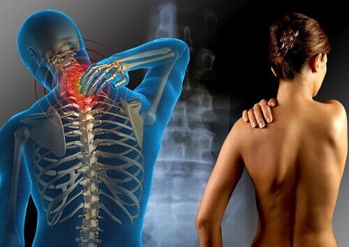 Behandeling van fibromyalgie met kruiden