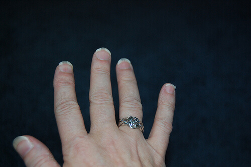 Schimmelnagel aan de Hand