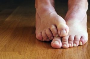 Huismiddelen tegen schimmelnagels