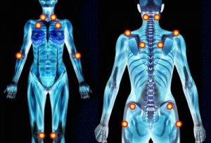 Kruiden die de symptomen van fibromyalgie verlichten